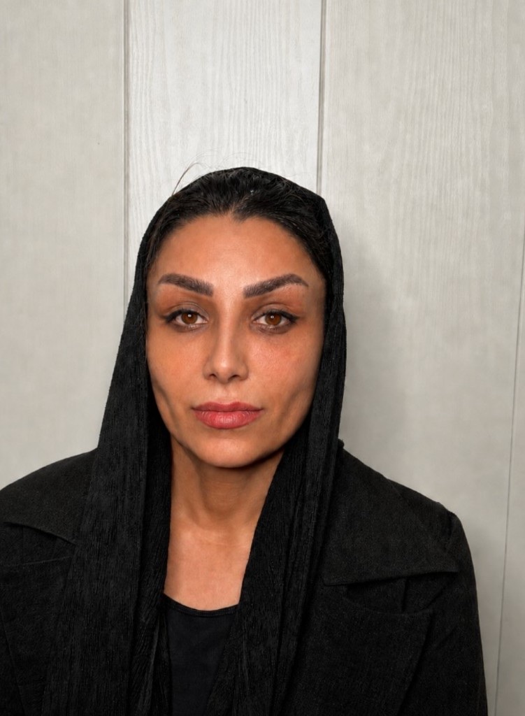 Frontal after photograph of temple lift and rhinoplasty, published with patient consent