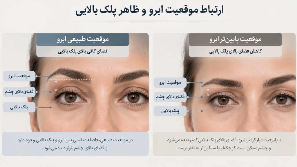 ارتباط موقعیت ابرو و ظاهر پلک بالایی