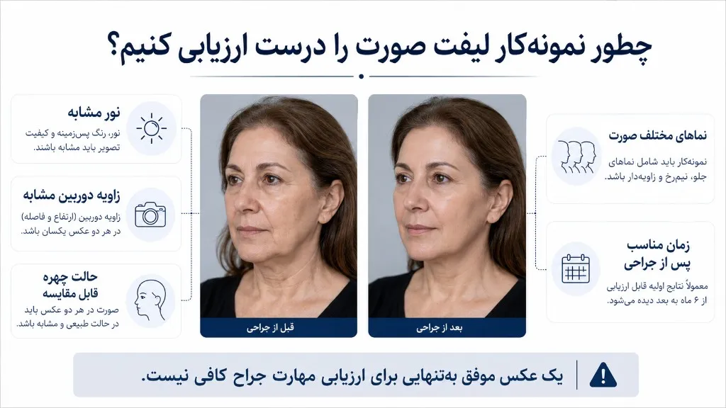 چطور نمونه‌کار لیفت صورت را درست ارزیابی کنیم؟ معیارهای نور، زاویه، حالت چهره و زمان پس از جراحی
