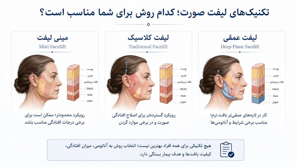 تکنیک‌های لیفت صورت؛ مینی لیفت، لیفت کلاسیک و لیفت عمقی