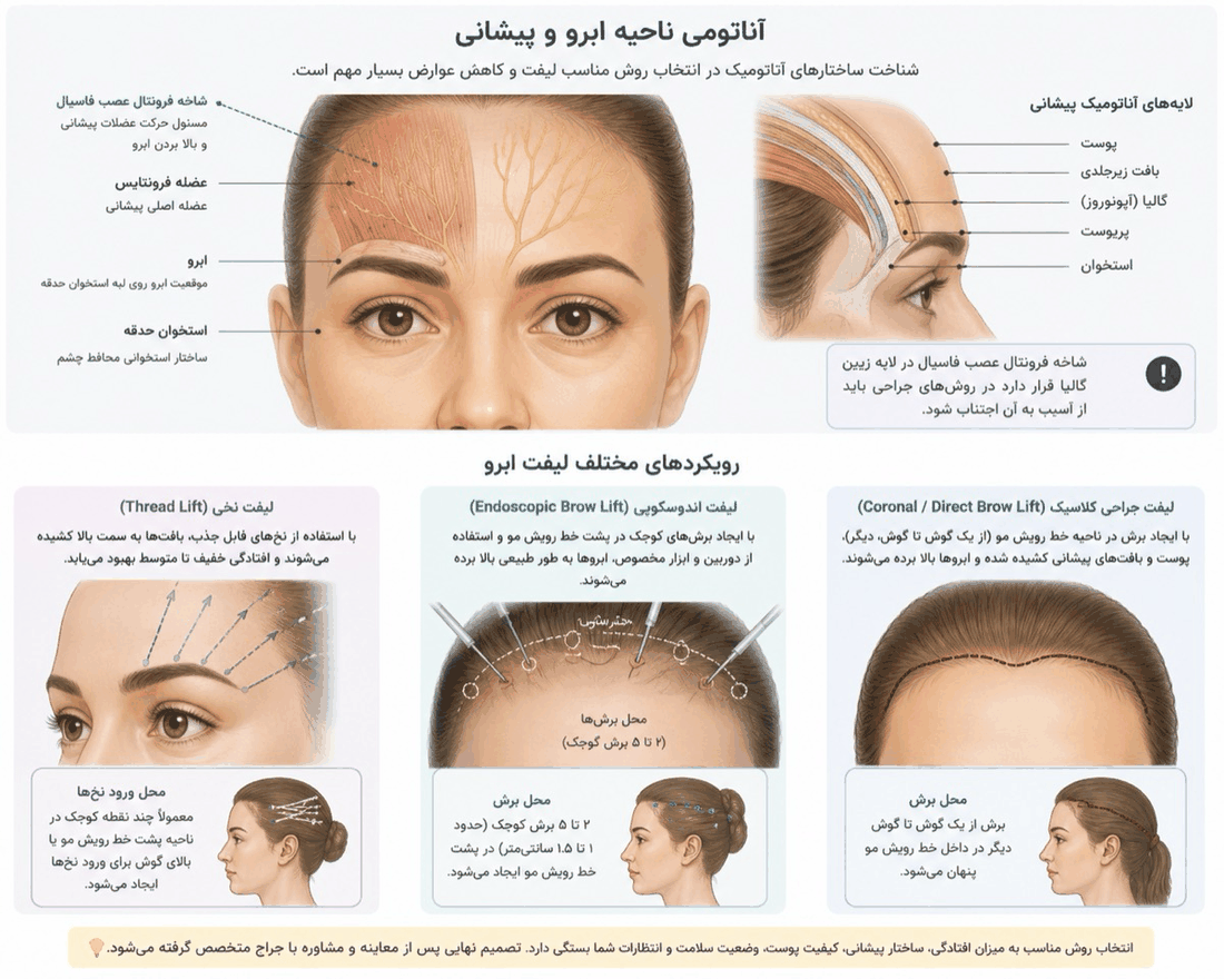 نمودار آناتومی ناحیه ابرو و پیشانی و رویکردهای جراحی لیفت ابرو