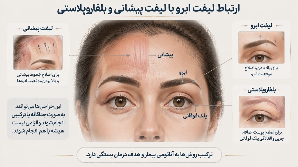 ارتباط لیفت ابرو با لیفت پیشانی و بلفاروپلاستی