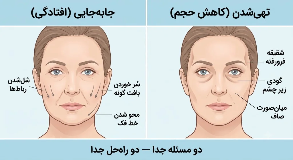 مقایسه جابه‌جایی (افتادگی) و تهی‌شدن (کاهش حجم) در پیری صورت