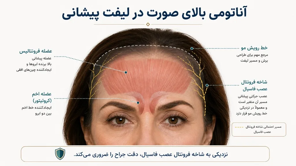 آناتومی بالای صورت در لیفت پیشانی: عضله فرونتالیس، عضله اخم، خط مو و شاخه فرونتال عصب فاسیال آناتومی بالای صورت در لیفت پیشانی: عضله فرونتالیس، عضله اخم، خط مو و شاخه فرونتال عصب فاسیال