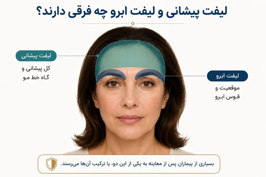 تفاوت لیفت پیشانی و لیفت ابرو: کل پیشانی و گاه خط مو در برابر موقعیت و قوس ابرو تفاوت لیفت پیشانی و لیفت ابرو: کل پیشانی و گاه خط مو در برابر موقعیت و قوس ابرو