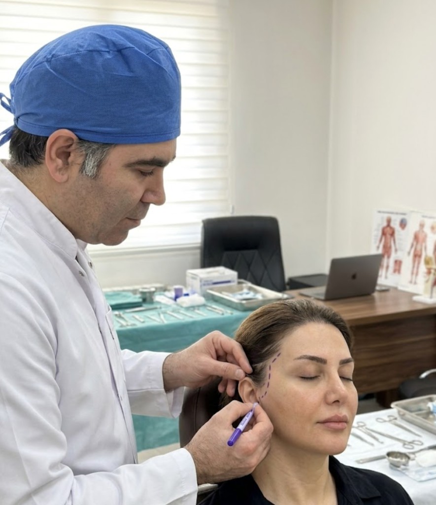 نشانه‌گذاری پیش از عمل مینی لیفت در مسیر طبیعی جلوی گوش و خط مو