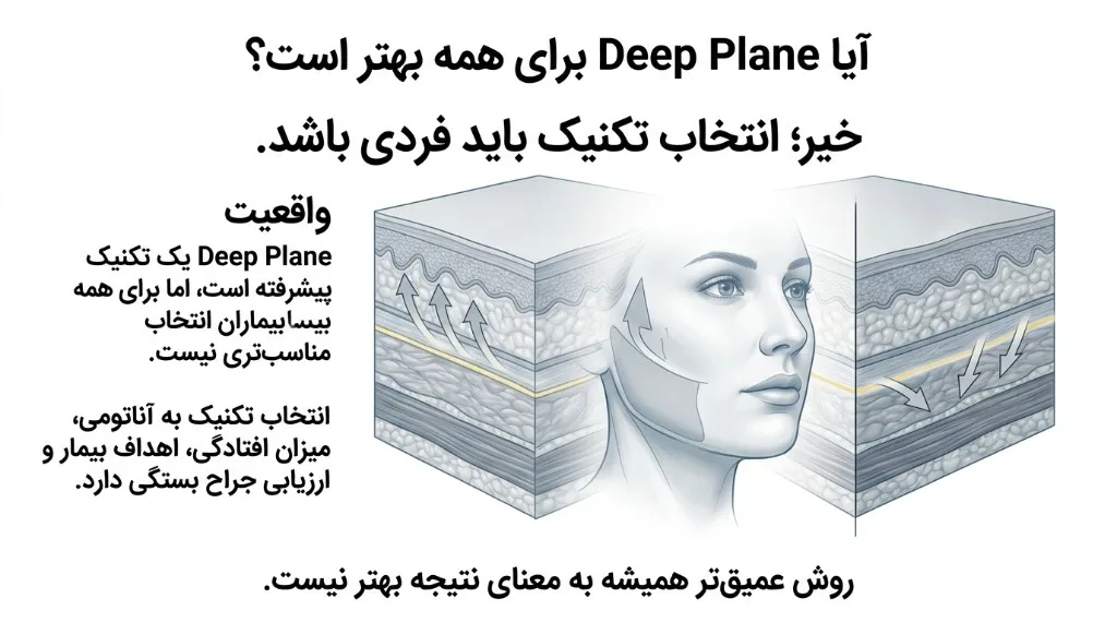 آیا Deep Plane برای همه بهتر است؟