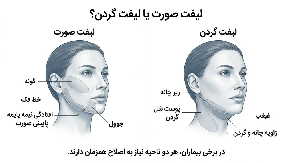 لیفت صورت یا لیفت گردن؟