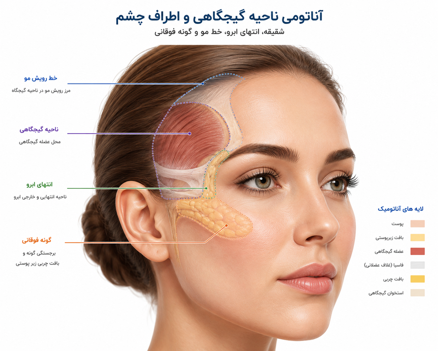 ناحیه شقیقه و ارتباط آن با افتادگی گوشه ابرو و نگاه خسته